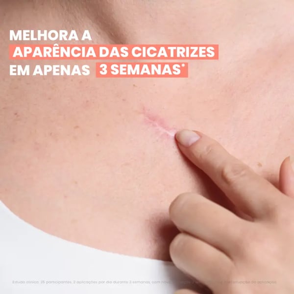 avene-gel-remodelador-cicatrizes-6.webp
