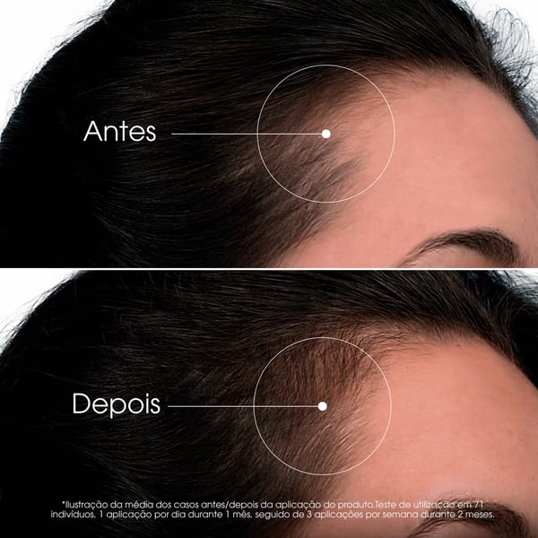 klorane-capilar-quinina-serum-acelerador-de-crescimento-intenso-100ml-6.webp